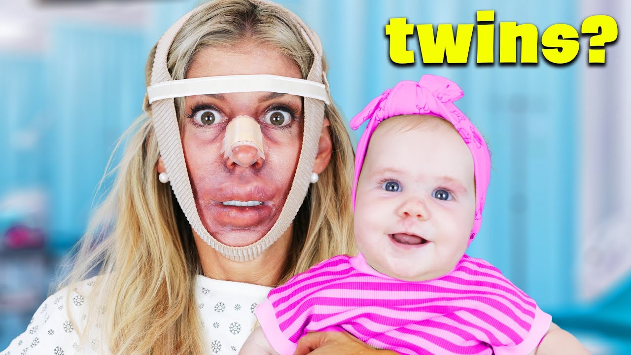 I Got Plastic Surgery to Twin My Baby